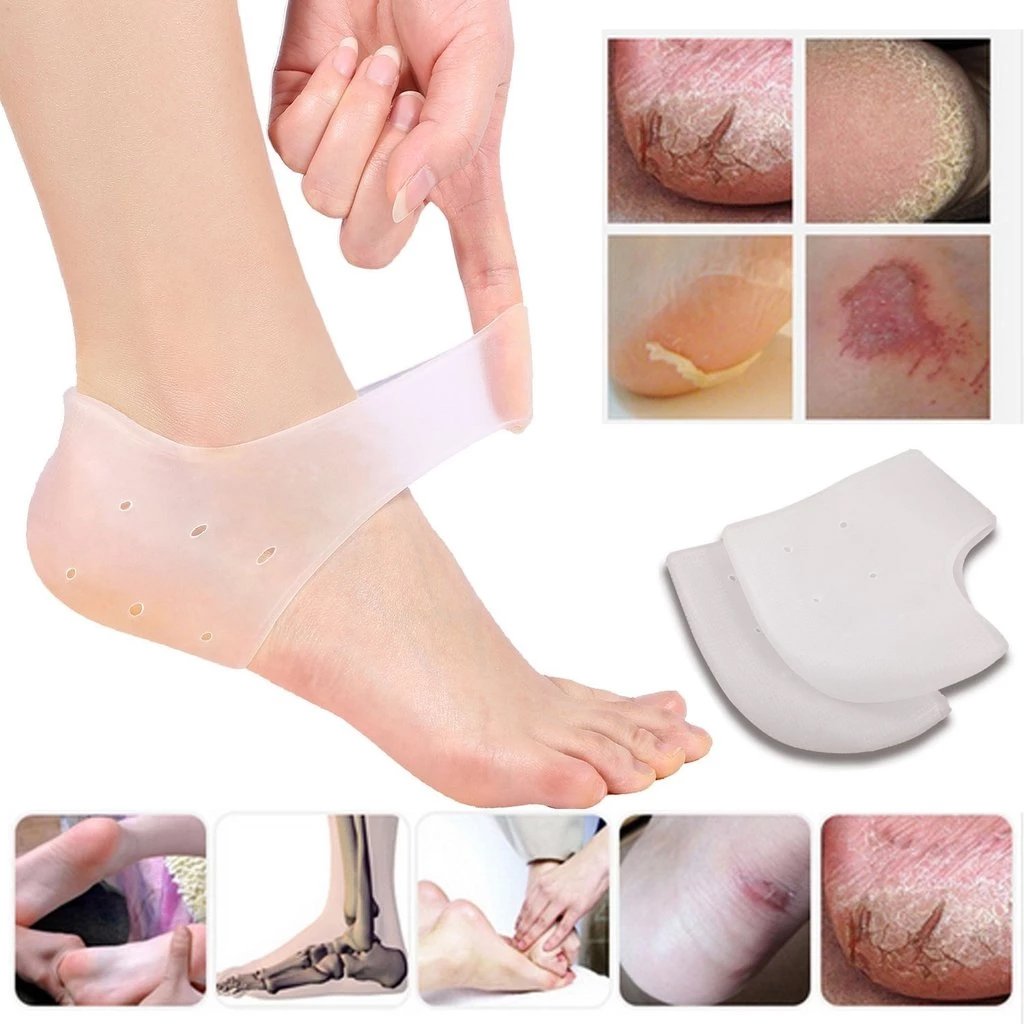 Silicone gel for moisturizing and repairing cracked heels. Silicone gel for moisturizing and repairing cracked heels.
